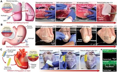 Hydrogel-Based Biomaterials Engineered from Natural-Derived Polysaccharides and Proteins for Hemostasis and Wound Healing